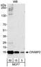 Cellular Retinoic Acid Binding Protein 2 antibody, NB100-2590, Novus Biologicals, Western Blot image 