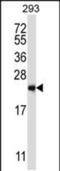 RAB1B, Member RAS Oncogene Family antibody, PA5-48635, Invitrogen Antibodies, Western Blot image 