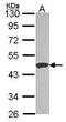 Carboxypeptidase B1 antibody, PA5-29993, Invitrogen Antibodies, Western Blot image 