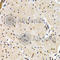 Interferon Regulatory Factor 2 antibody, A2558, ABclonal Technology, Immunohistochemistry paraffin image 