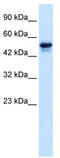 SET Domain Containing 4 antibody, TA335546, Origene, Western Blot image 