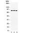 MNAT1 Component Of CDK Activating Kinase antibody, R32131, NSJ Bioreagents, Western Blot image 