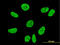 VPS50 Subunit Of EARP/GARPII Complex antibody, LS-C105155, Lifespan Biosciences, Immunofluorescence image 
