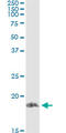 Prosolin antibody, LS-C197602, Lifespan Biosciences, Immunoprecipitation image 