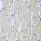 Colony Stimulating Factor 3 Receptor antibody, orb373677, Biorbyt, Immunohistochemistry paraffin image 