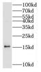 Synuclein Beta antibody, FNab08062, FineTest, Western Blot image 