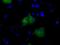 Bruton Tyrosine Kinase antibody, GTX84792, GeneTex, Immunofluorescence image 