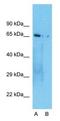 Cryptochrome Circadian Regulator 1 antibody, NBP1-69080, Novus Biologicals, Western Blot image 