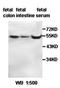 ADAM Like Decysin 1 antibody, orb77739, Biorbyt, Western Blot image 