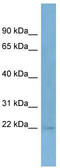 Taspase 1 antibody, TA344970, Origene, Western Blot image 