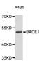 Phosphatase And Tensin Homolog antibody, abx125227, Abbexa, Western Blot image 