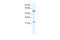 Programmed Cell Death 4 antibody, 31-081, ProSci, Enzyme Linked Immunosorbent Assay image 