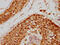 SIVA1 Apoptosis Inducing Factor antibody, LS-C370333, Lifespan Biosciences, Immunohistochemistry paraffin image 