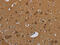 Nuclear Receptor Subfamily 3 Group C Member 1 antibody, CSB-PA225804, Cusabio, Immunohistochemistry paraffin image 