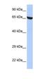 Zinc Finger Protein 528 antibody, orb324628, Biorbyt, Western Blot image 