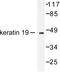 Keratin 19 antibody, LS-C176097, Lifespan Biosciences, Western Blot image 