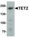 Tet Methylcytosine Dioxygenase 2 antibody, LS-C336148, Lifespan Biosciences, Western Blot image 