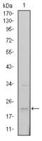 Snail Family Transcriptional Repressor 1 antibody, M00716, Boster Biological Technology, Western Blot image 