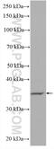 Thymidylate Synthetase antibody, HRP-66725, Proteintech Group, Western Blot image 