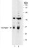 15-Hydroxyprostaglandin Dehydrogenase antibody, PA5-22892, Invitrogen Antibodies, Western Blot image 