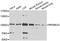 Ribosomal Protein S6 Kinase A3 antibody, A0177, ABclonal Technology, Western Blot image 