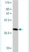 HMG-Box Containing 4 antibody, H00010042-M01, Novus Biologicals, Western Blot image 