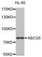 ATP Binding Cassette Subfamily G Member 5 antibody, LS-C410124, Lifespan Biosciences, Western Blot image 