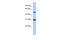 Peptidase Inhibitor 16 antibody, 31-311, ProSci, Western Blot image 