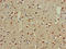 Cell Adhesion Molecule 3 antibody, LS-C677368, Lifespan Biosciences, Immunohistochemistry paraffin image 