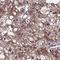 Nicotinamide N-Methyltransferase antibody, HPA059180, Atlas Antibodies, Immunohistochemistry paraffin image 