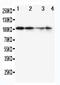 Minichromosome Maintenance Complex Component 2 antibody, PA1650, Boster Biological Technology, Western Blot image 