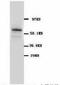 Solute Carrier Family 1 Member 3 antibody, LS-C171740, Lifespan Biosciences, Western Blot image 