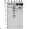 PTK7 antibody, LS-C813996, Lifespan Biosciences, Western Blot image 