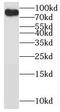 BR Serine/Threonine Kinase 2 antibody, FNab00966, FineTest, Western Blot image 