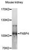 Formin Binding Protein 4 antibody, LS-C748827, Lifespan Biosciences, Western Blot image 