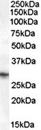 Paired Related Homeobox 1 antibody, orb19685, Biorbyt, Western Blot image 