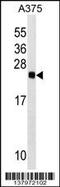 RAB2B, Member RAS Oncogene Family antibody, 59-527, ProSci, Western Blot image 