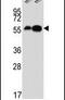 Dopa Decarboxylase antibody, PA5-25450, Invitrogen Antibodies, Western Blot image 