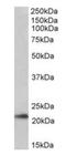 Transmembrane Protein 205 antibody, orb125083, Biorbyt, Western Blot image 