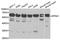 Karyopherin Subunit Alpha 1 antibody, A13623, ABclonal Technology, Western Blot image 