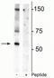 Solute Carrier Family 6 Member 3 antibody, P00369, Boster Biological Technology, Western Blot image 