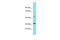 Rho Family GTPase 3 antibody, A04727, Boster Biological Technology, Western Blot image 