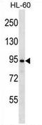 Ubiquitin Specific Peptidase 37 antibody, AP54447PU-N, Origene, Western Blot image 