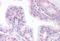 ETS Transcription Factor ERG antibody, MBS240205, MyBioSource, Immunohistochemistry paraffin image 