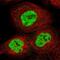 RNA Binding Motif Protein 10 antibody, NBP1-84951, Novus Biologicals, Immunofluorescence image 