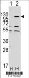 EPH Receptor A7 antibody, 63-048, ProSci, Western Blot image 