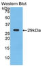 Neuronal Pentraxin 1 antibody, LS-C295588, Lifespan Biosciences, Western Blot image 