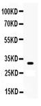 Orthodenticle Homeobox 2 antibody, PA5-79777, Invitrogen Antibodies, Western Blot image 