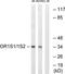 Olfactory receptor OR11-231 antibody, TA316243, Origene, Western Blot image 