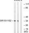 Olfactory Receptor Family 1 Subfamily S Member 2 antibody, TA316243, Origene, Western Blot image 